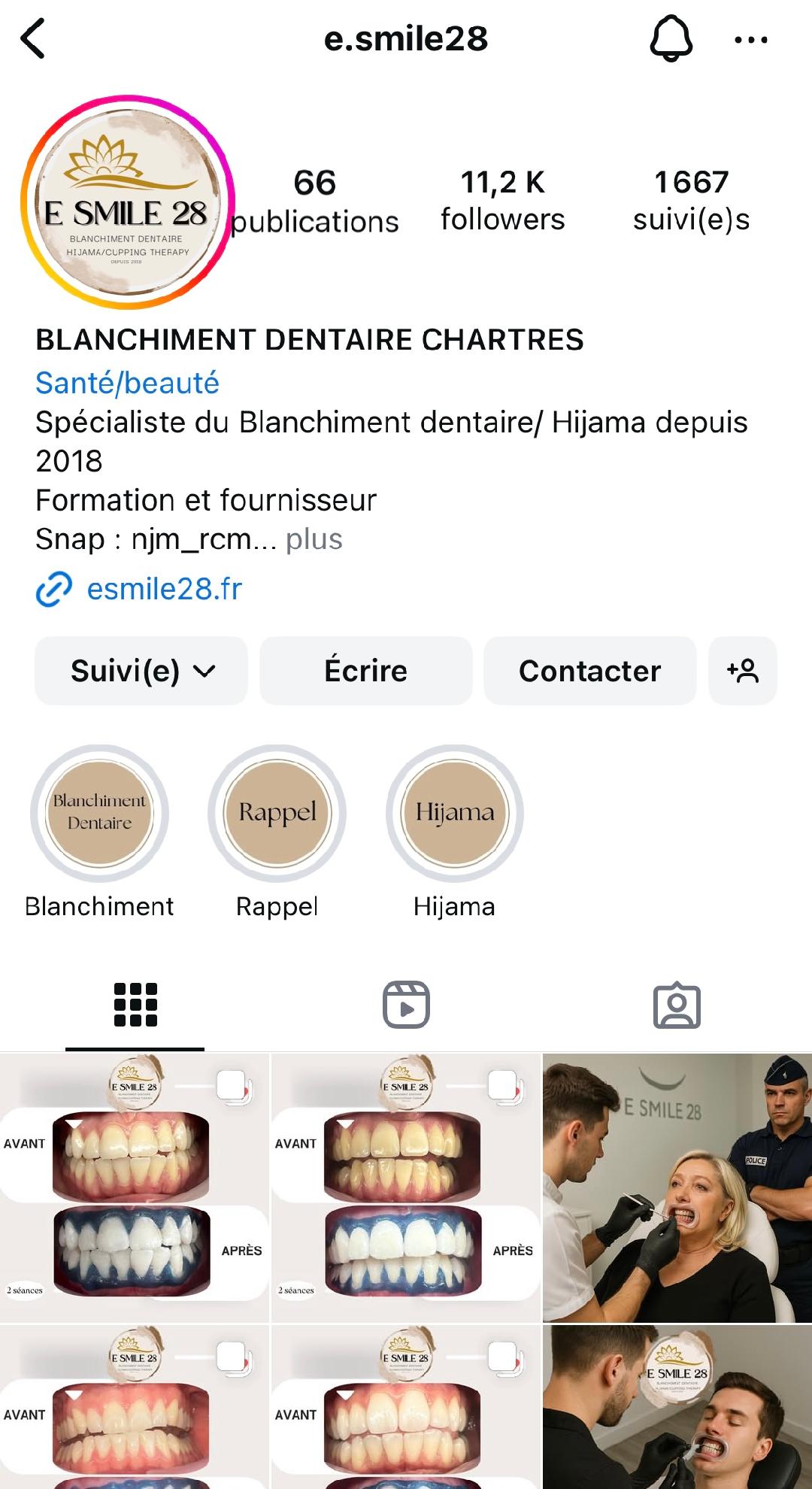 instagram blanchiment dentaire